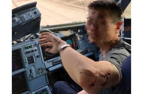 Sichan first officer injury-c-CAAC